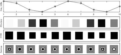 A Radial Zoom Motion-Based Paradigm for Steady State Motion Visual Evoked Potentials